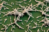 The Basfia succiniciproducens bacterium produces fumarate. At the same time it fixes the greenhouse gas carbon dioxide. Magnification 4000:1 (bei 12 cm in width) The Basfia succiniciproducens bacterium produces fumarate. At the same time it fixes the greenhouse gas carbon dioxide. Magnification 4000:1 (bei 12 cm in width)