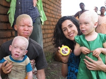 Mafalda Soto, Mitbegründerin von Beyond Suncare, verteilt das gemeinsam mit BASF entwickelte Sonnenschutzmittel an Menschen mit Albinismus in Malawi. ©Beyond Suncare
