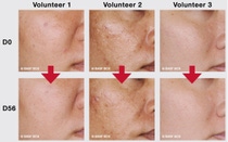 56日間連用による肌の変化