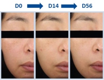 ブライトニング効果