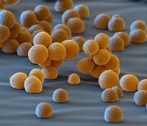 BASF is conducting global research into innovative cathode active materials that, depending on their composition, can be used in batteries for small to luxury cars. That’s how innovations from BASF are helping to further advance electromobility. Cathode active materials whose particles are as uniform as possible and have a regular surface area can be packed more homogeneously and densely in the electrode. This results in a longer driving range for the electric car. Magnification 1400:1